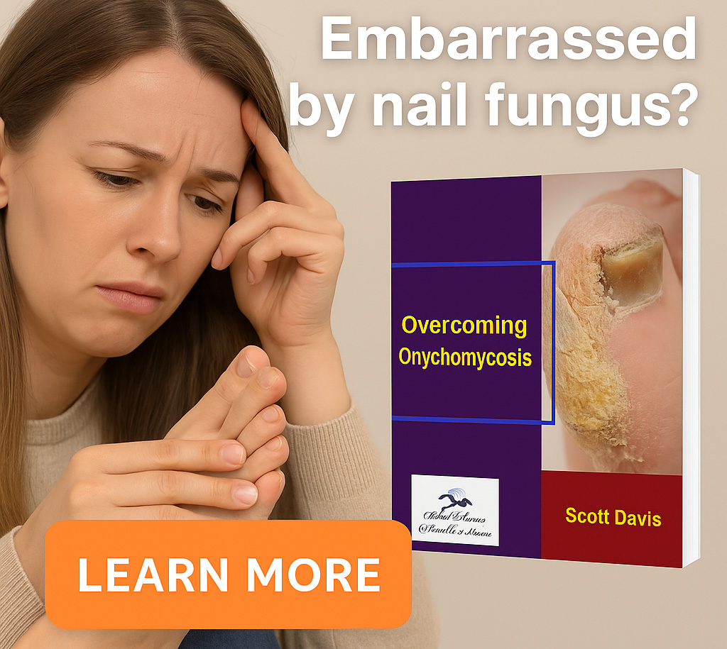Banner Onychomycosis
